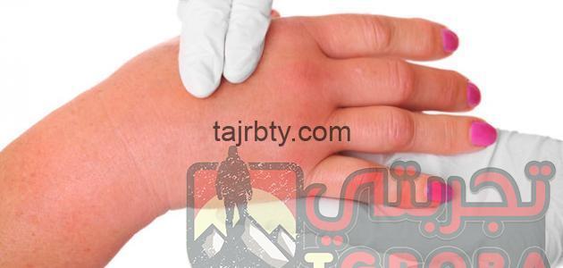 علاج الأملاح في الجسم جابر القحطاني تجربتي