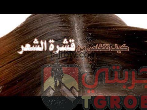 وصفة لقشرة الشعر مجربة