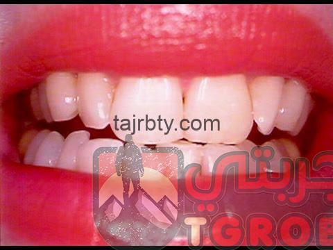 Photo of وصفة مجربة لتبييض الأسنان
