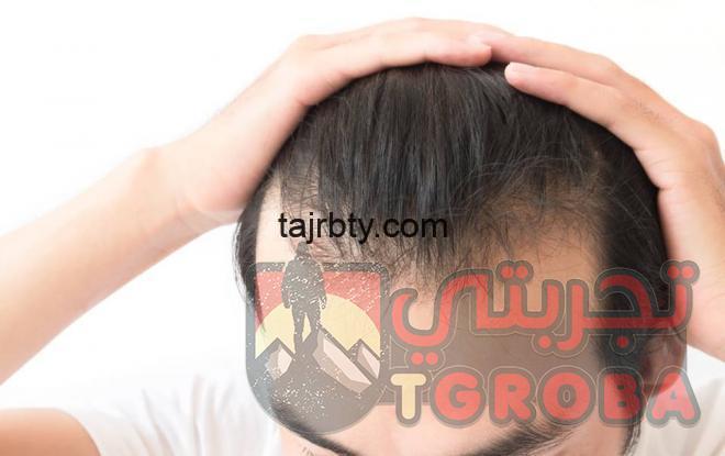 تجارب زراعة الشعر عند الدكتور يتكين باير 2020