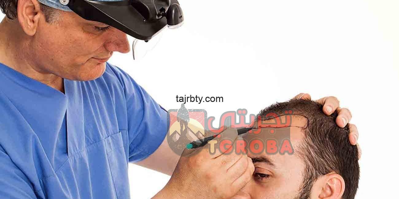 استخدام الزيوت بعد زراعة الشعر