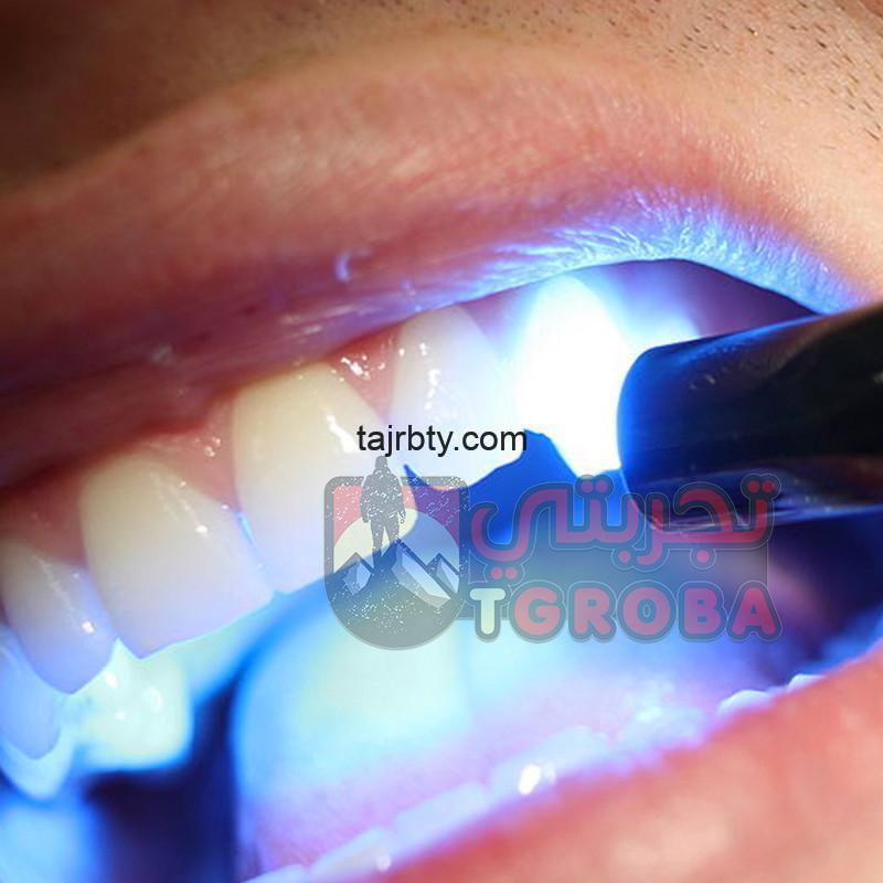 Photo of تلميع الأسنان بالليزر ما هي مميزاته وعيوبه ومضاعفات تبييض الأسنان بالليزر
