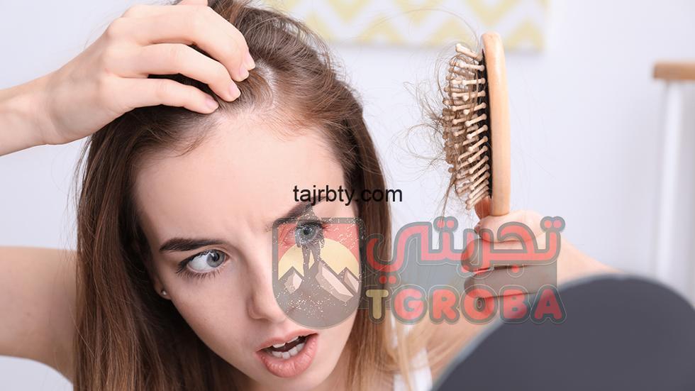 Photo of علاج تساقط الشعر الشديد عند النساء بخلطات طبيعية مضمونة في المنزل وفعالة 100%