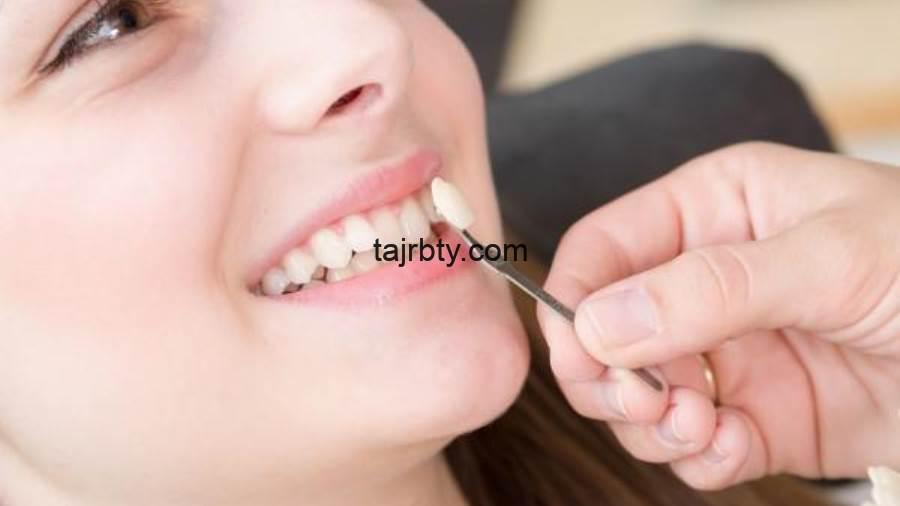 Photo of تجربتي مع الفينير المتحرك لتجميل الأسنان