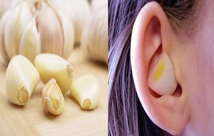 الثوم لفطريات الأذن